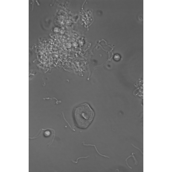 Hund Microscoop Medicus PH Plan, trino, 100x-1000x