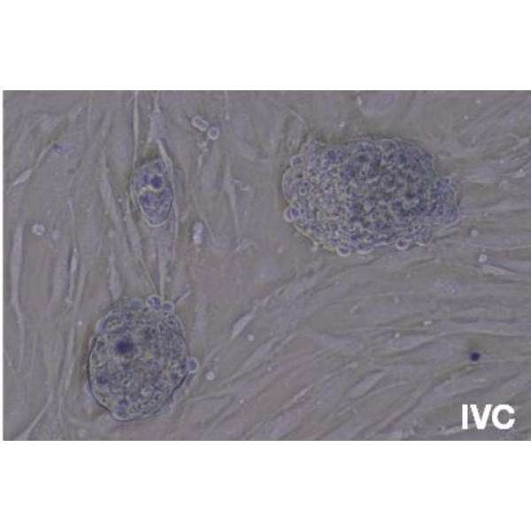 Evident Olympus Omgekeerde microscoop Olympus CKX53 met tafelaandrijving, trino, infinity, plan achro, LED, zonder Lenzen!