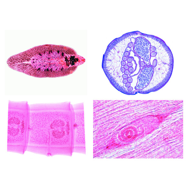 LIEDER Parasitologie, grote serie, 50 preparaten