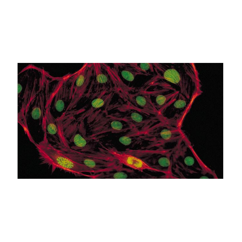 Evident Olympus Microscoop CX41 Fluorescentie, trino, Hal, 40x,100x, 400x