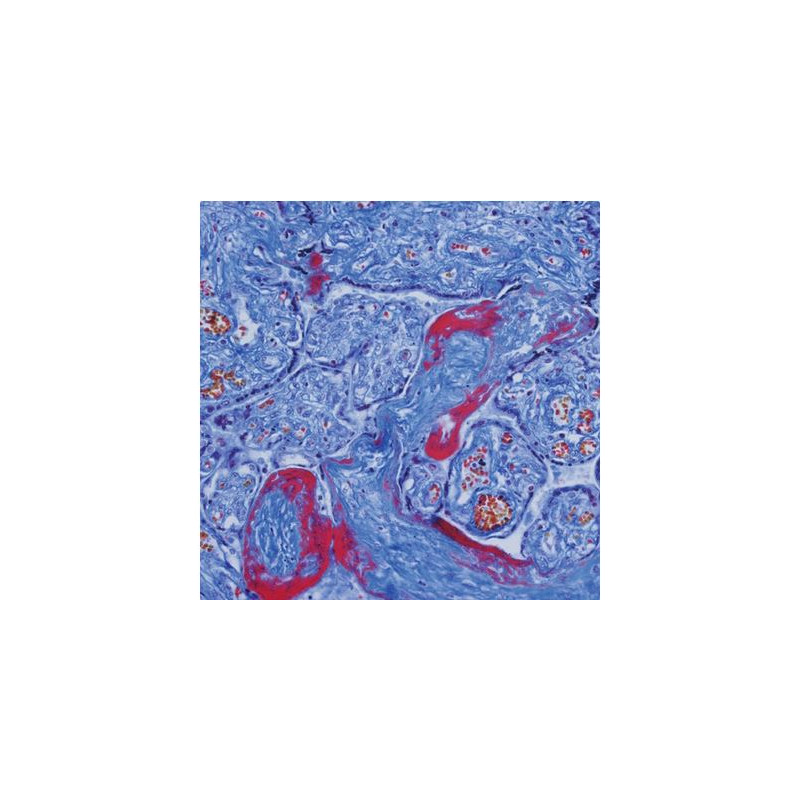 Evident Olympus Microscoop CX41 cytology, halogen, trino 40x,100x, 400x